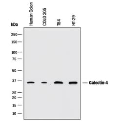 Invitrogen Galectin 4 Monoclonal Antibody (198616) 500 &mu;g; Unconjugated:Antibodies,