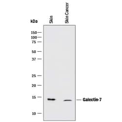 Invitrogen Galectin 7 Monoclonal Antibody (950756) 100 &mu;g; Unconjugated:Antibodies,