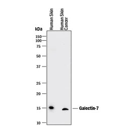 Invitrogen Galectin 7 Monoclonal Antibody (950723) 100 &mu;g; Unconjugated:Antibodies,
