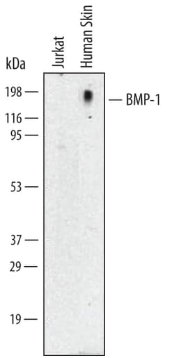 Invitrogen BMP1 Monoclonal Antibody (264822) 500 &mu;g; Unconjugated:Antibodies,