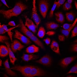 Invitrogen Pleiotrophin Monoclonal Antibody (851406) 100 &mu;g; Unconjugated:Antikörper