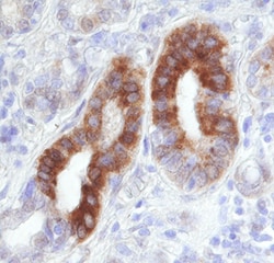 Invitrogen RelB Monoclonal Antibody (315206) 100 &mu;g; Unconjugated:Antibodies,