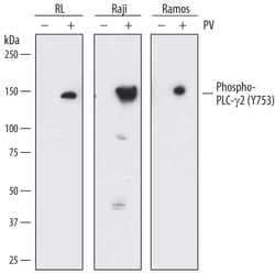 Invitrogen Phospho-PLCG2 (Tyr753) Monoclonal Antibody (790623) 100 &mu;g;