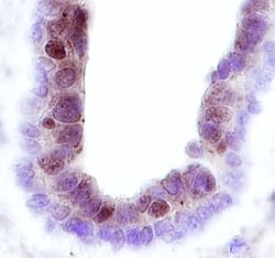 Invitrogen FRK Monoclonal Antibody (393812) 100 &mu;g | Buy Online | Invitrogen&trade; | Fisher Scientific