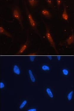 Invitrogen TCF3 Monoclonal Antibody (401709) 100 &mu;g; Unconjugated:Antibodies,
