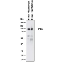 Invitrogen PKC epsilon Monoclonal Antibody (666843) 100 &mu;g; Unconjugated:Antikörper