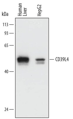 Invitrogen ENTPD5 Monoclonal Antibody (743512) 100 &mu;g; Unconjugated:Antibodies,