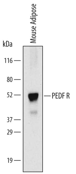 Invitrogen ATGL Monoclonal Antibody (615728) 100 &mu;g; Unconjugated:Antibodies,