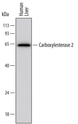 Invitrogen CES2 Monoclonal Antibody (720711) 100 &mu;g; Unconjugated:Antibodies,