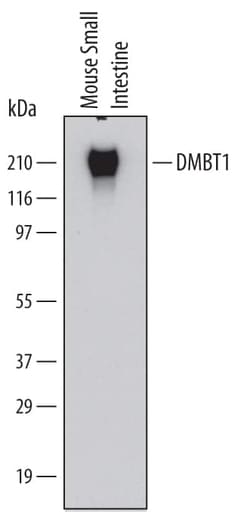 Invitrogen&trade;&nbsp;GP340 Monoclonal Antibody (548012)