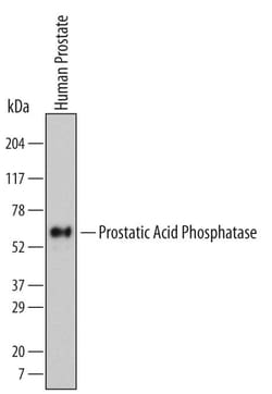 Invitrogen Prostate Specific Acid Phosphatase Monoclonal Antibody (690017) 100 &mu;g | Buy Online | Invitrogen&trade; | Fisher Scientific