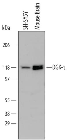 Invitrogen DGKI Monoclonal Antibody (648538) 100 &mu;g; Unconjugated:Antibodies,