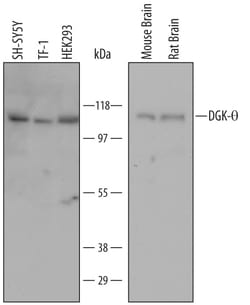 Invitrogen DGKQ Monoclonal Antibody (652308) 100 &mu;g; Unconjugated:Antibodies,
