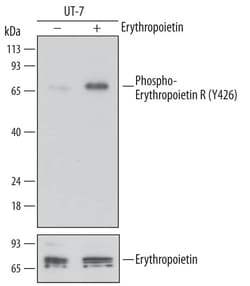 Invitrogen Phospho-EpoR (Tyr426) Monoclonal Antibody (690710) 100 &mu;g;