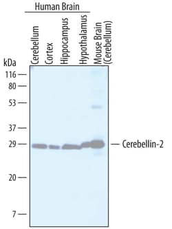 Invitrogen Cerebellin 2 Monoclonal Antibody (704330) 100 &mu;g; Unconjugated:Antikörper