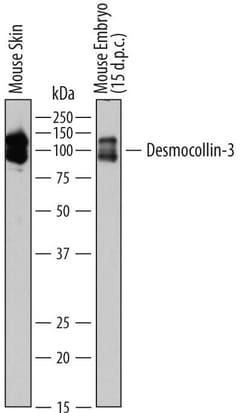 Invitrogen Desmocollin 3 Monoclonal Antibody (765129) 100 &mu;g; Unconjugated:Antibodies,