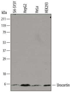 Invitrogen Urocortin Monoclonal Antibody (749606) 100 &mu;g; Unconjugated:Antibodies,