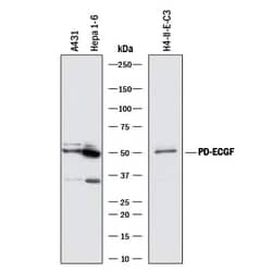 Invitrogen Thymidine Phosphorylase Monoclonal Antibody (826722) 100 &mu;g;