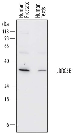 Invitrogen LRP15 Monoclonal Antibody (758315) 100 &mu;g; Unconjugated:Antibodies,