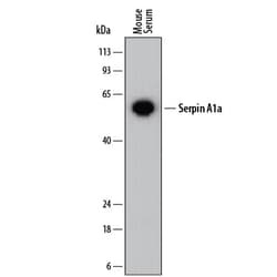 Invitrogen alpha-1 Antitrypsin Monoclonal Antibody (882213) 100 &mu;g;