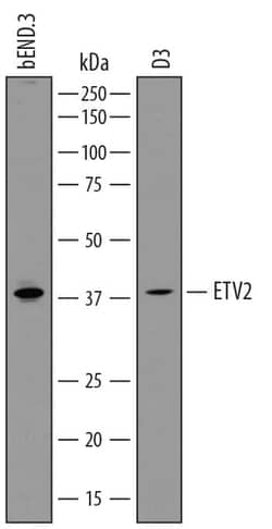 Invitrogen ETV2 Monoclonal Antibody (827940) 100 &mu;g; Unconjugated:Antibodies,