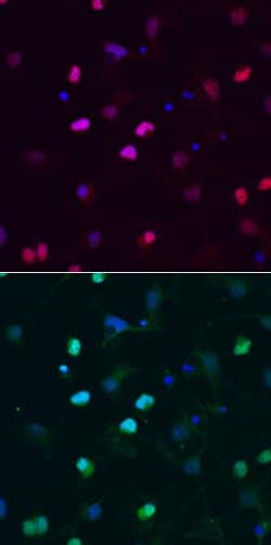 Invitrogen SOX6 Monoclonal Antibody (667136) 100 &mu;g; Unconjugated:Antibodies,