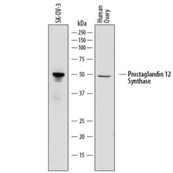 Invitrogen PTGIS Monoclonal Antibody (852307) 100 &mu;g; Unconjugated:Antikörper