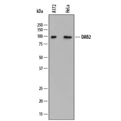 Invitrogen DAB2 Monoclonal Antibody (883216) 100 &mu;g; Unconjugated:Antibodies,