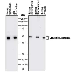 Invitrogen Creatine Kinase BB Monoclonal Antibody (969409) 100 &mu;g; Unconjugated:Antibodies,