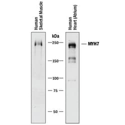 Invitrogen MYH7 Monoclonal Antibody (940906) 100 &mu;g; Unconjugated:Antibodies,