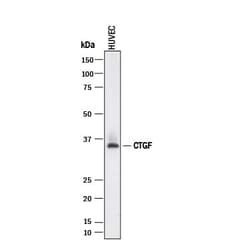 Invitrogen CTGF Monoclonal Antibody (965021) 100 &mu;g; Unconjugated:Antibodies,