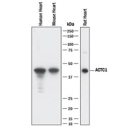 Invitrogen alpha-Cardiac Actin Monoclonal Antibody (959606) 100 &mu;g;