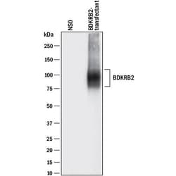 Invitrogen BDKRB2 Monoclonal Antibody (471902) 100 &mu;g; Unconjugated:Antibodies,
