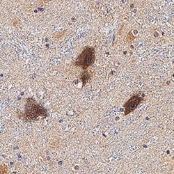 Invitrogen Neurophysin II Monoclonal Antibody (62865) 100 &mu;g; Unconjugated:Antibodies,