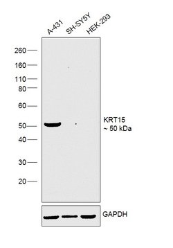 Invitrogen Cytokeratin 15 Monoclonal Antibody (LHK15) 500 &mu;L; Unconjugated:Antibodies,
