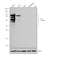Invitrogen Involucrin Monoclonal Antibody (SY5) 500 &mu;L; Unconjugated:Antibodies,