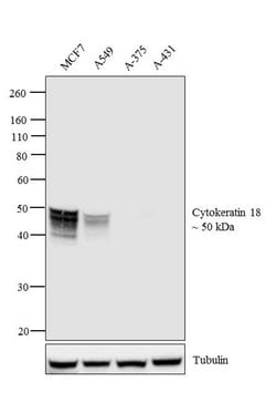 Invitrogen Cytokeratin 18 Monoclonal Antibody (DC10) 500 &mu;L; Unconjugated:Antikroppar