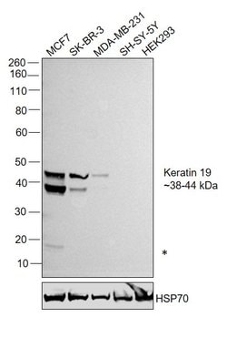 Invitrogen Cytokeratin 19 Monoclonal Antibody (BA17) 500 &mu;L | Buy Online | Invitrogen&trade; | Fisher Scientific