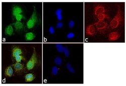 CA19-9 Monoclonal Antibody (116-NS-19-9):Antibodies, Monoclonal