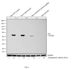p53 Monoclonal Antibody (DO-1):Antibodies, Monoclonal