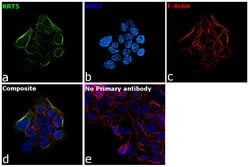 Invitrogen Cytokeratin 5 Monoclonal Antibody (XM26) 500 &mu;L; Unconjugated:Antibodies,