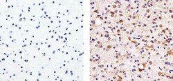 Invitrogen Tau Monoclonal Antibody (TAU-5) 100 &mu;g; Unconjugated:Antibodies,