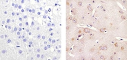 Invitrogen Tau Monoclonal Antibody (TAU-5) 100 &mu;g; Unconjugated:Antibodies,