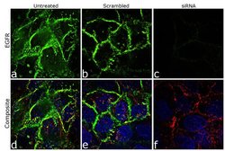Invitrogen EGFR Monoclonal Antibody (225) 500 &mu;L; Unconjugated:Antibodies,
