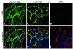 Invitrogen EGFR Monoclonal Antibody (225) 500 &mu;L; Unconjugated:Antibodies,
