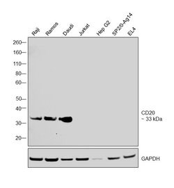 Invitrogen CD20 Monoclonal Antibody (L26) 500 &mu;L; Unconjugated:Antibodies,