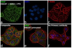 Invitrogen VEGF Monoclonal Antibody (JH121) 500 &mu;L; Unconjugated:Antikörper