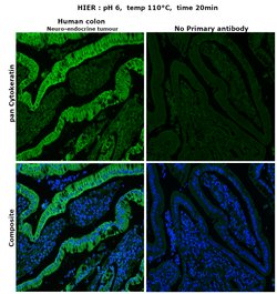 Invitrogen Cytokeratin Pan Antibody Cocktail 500 &mu;L; Unconjugated:Antibodies,