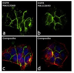 EGFR Monoclonal Antibody (111.6), Invitrogen 500 &mu;L | Buy Online | Thermo Scientific | Fisher Scientific