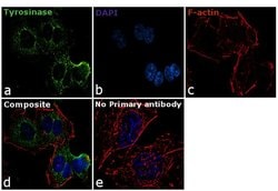 Invitrogen Tyrosinase Monoclonal Antibody (T311) 500 &mu;L; Unconjugated:Antibodies,